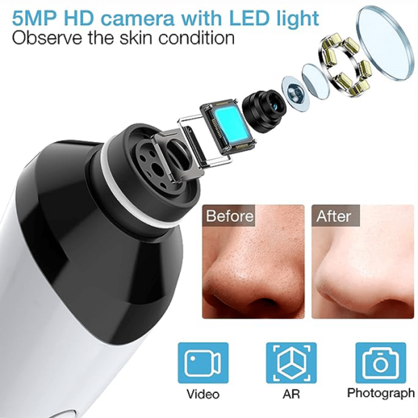 Aparat cu vacuum pentru puncte negre IMA Trend, puncte de grasime si cosuri, curatare si ingrijire faciala cu wi-fi si camera video, alb - imagine 7
