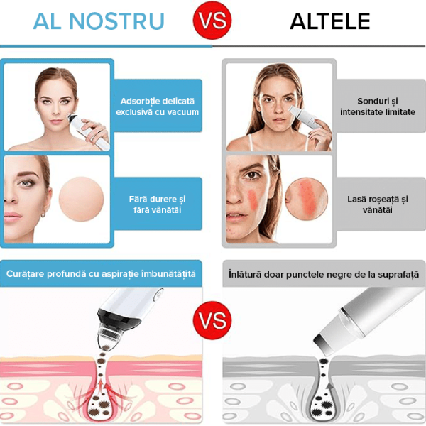 Aparat cu vacuum pentru puncte negre IMA Trend, puncte de grasime si cosuri, curatare si ingrijire faciala cu wi-fi si camera video, alb - imagine 6